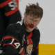 montreal canadiens ottawa senators blood